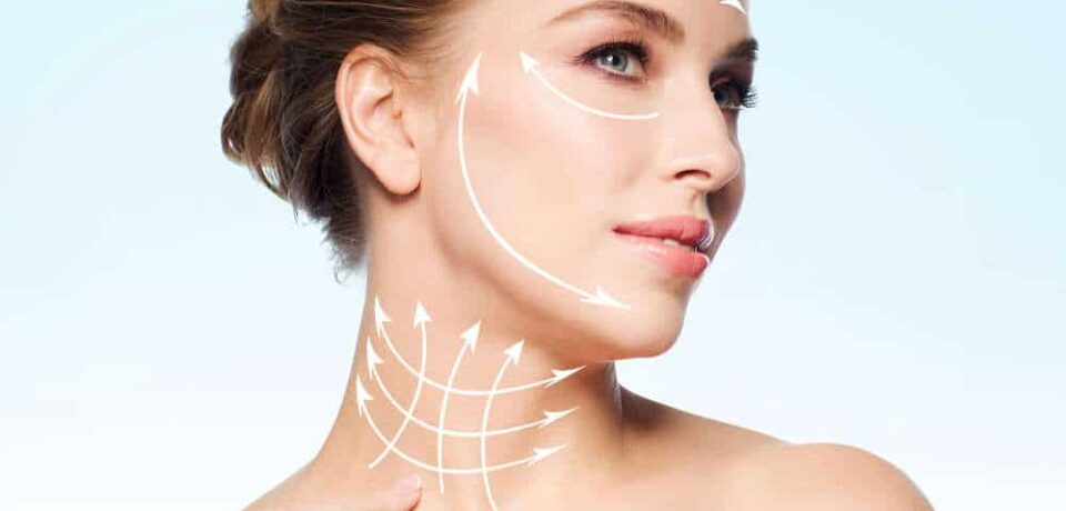 lifting-com-fios-de-pdo lifting-com-fios-de-pdo