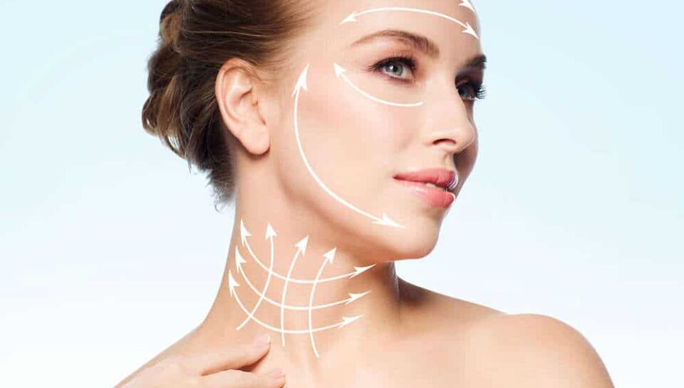 lifting-com-fios-de-pdo