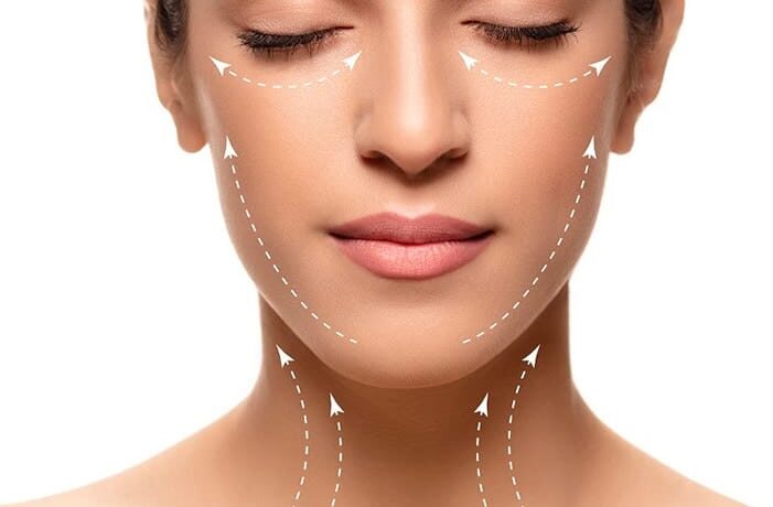 mulher representando o procedimento de harmonização facial no Grupo Caroline Antunes Dermatologia Barra da Tijuca Rio de Janeiro