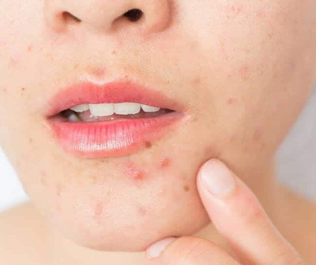 Dermatologia clínica
