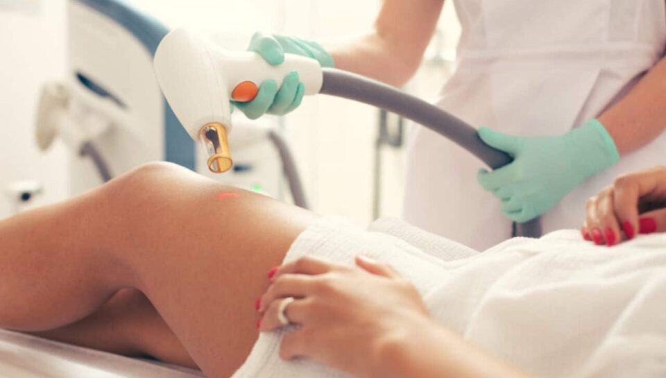 Entenda como funciona um tratamento para estrias!