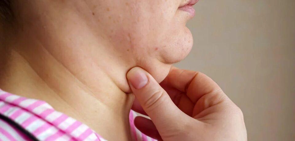 como-tirar-papada como-tirar-papada