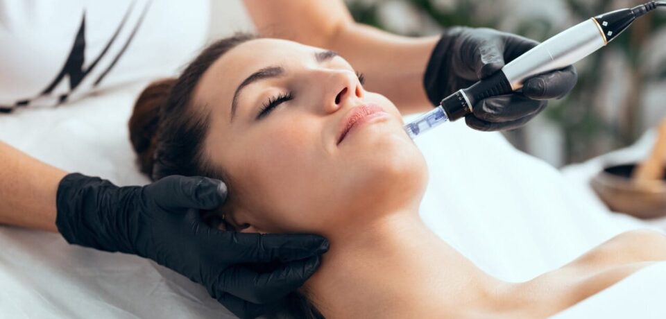 microagulhamento-beneficios (1) microagulhamento beneficios