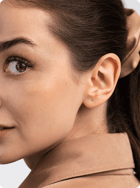 Correção de orelha rasgada (1)