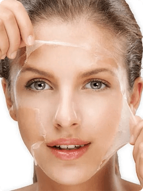 Peeling Qu&iacute;mico