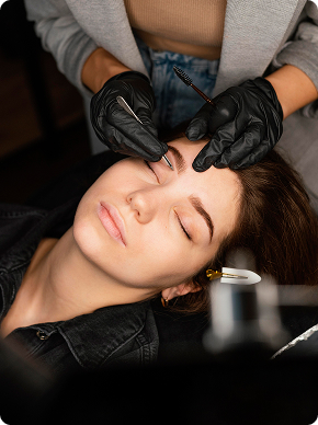 Remoção de micropigmentação