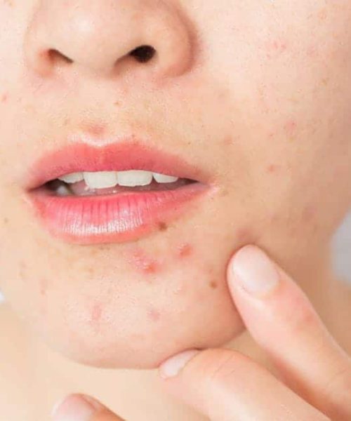 Dermatologia cl&iacute;nica